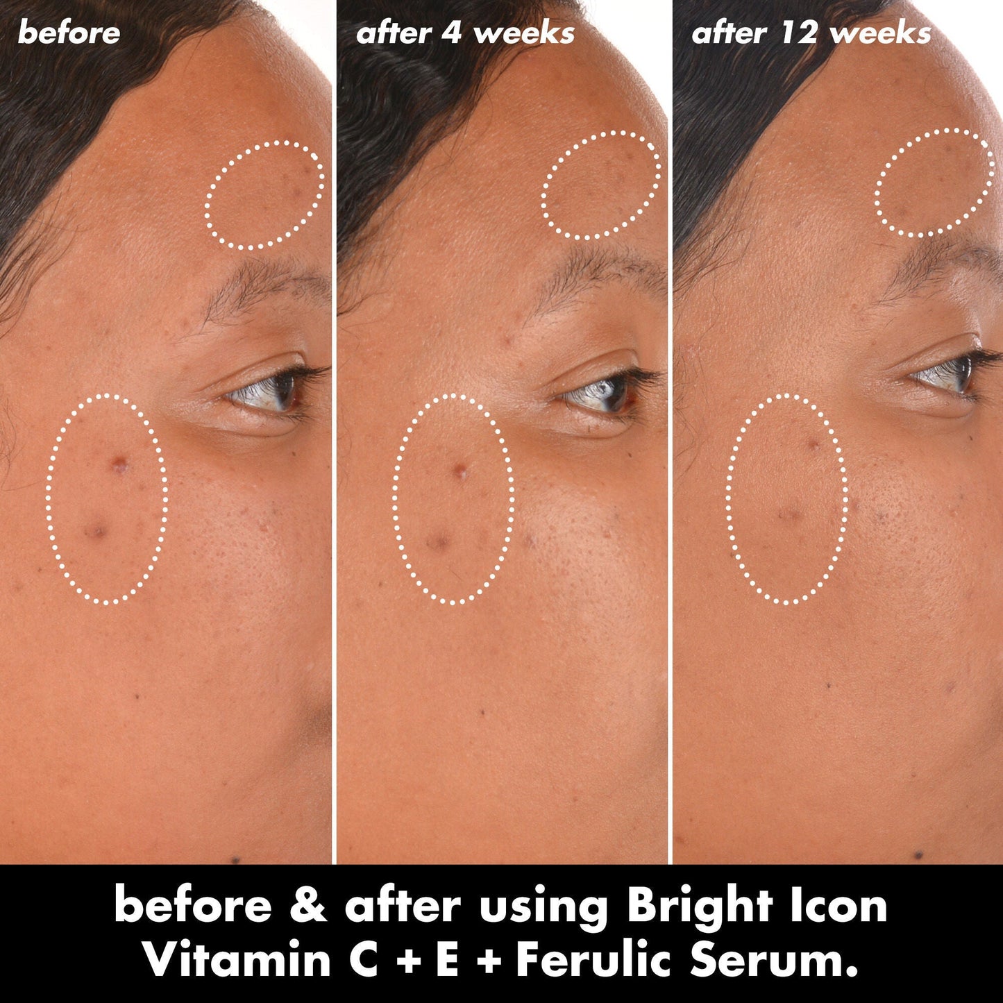 bright-icon-vitamin-c-e-ferulic-serum-k3 0226_EDU_BrightIconVitC_BA_Chanel_TRIPTYCH_c58f2fc8-209d-414f-9ba3-666a07a94887.jpg