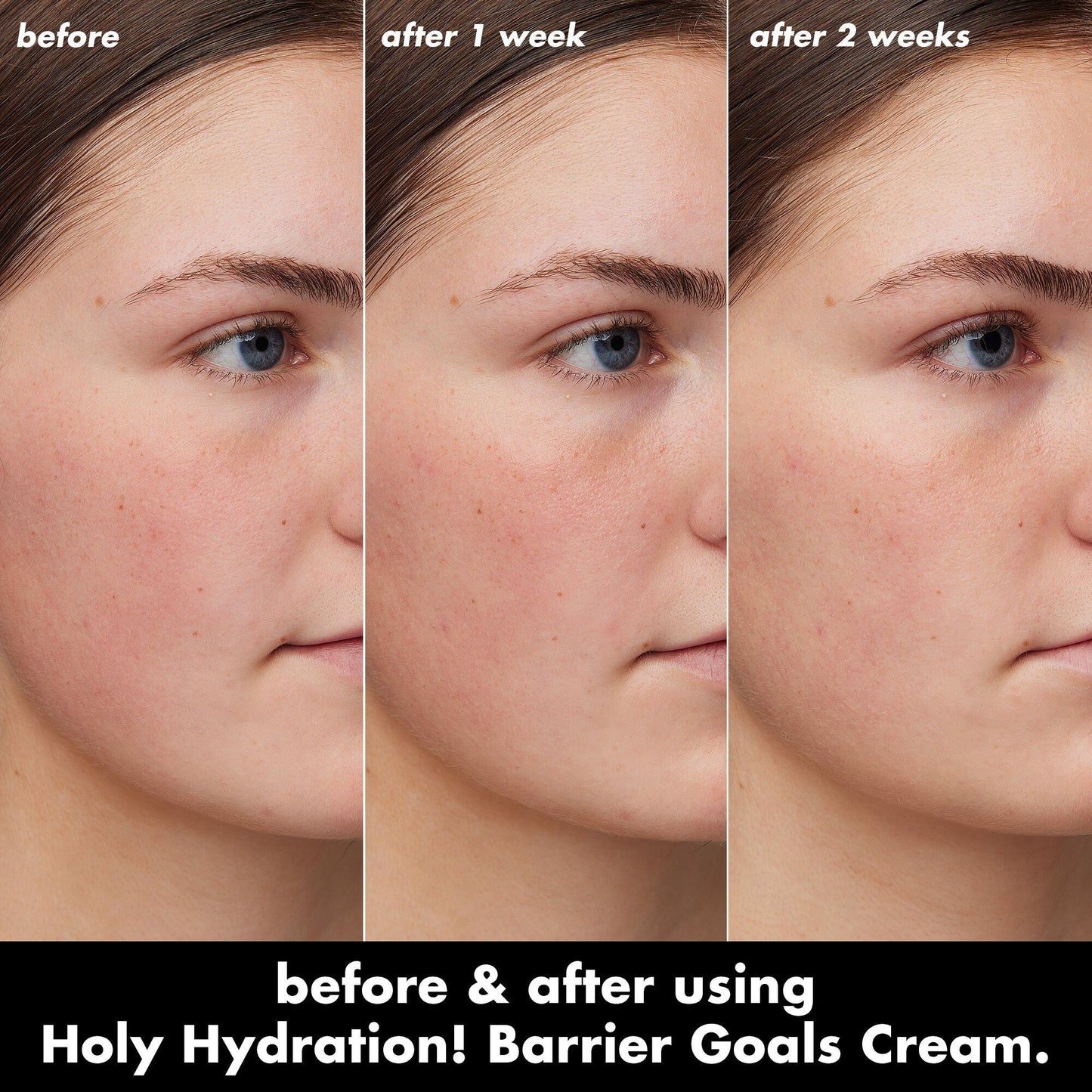 holy-hydration-barrier-goals-cream-x2 0226_EDU_HHBarrierGoalsCream_B_A_Zoe_TRYPTICH_710f5249-3a6b-41fd-89e4-817294dd9258.jpg