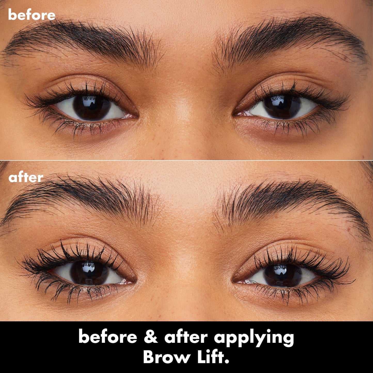 brow-lift-c2 0326_EDU_BrowLift_BA.jpg