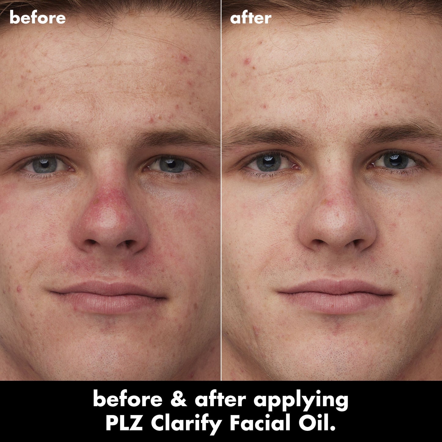 plz-clarify-facial-oil-q2 0326_EDU_PlzClarify_BA_Caleb.jpg
