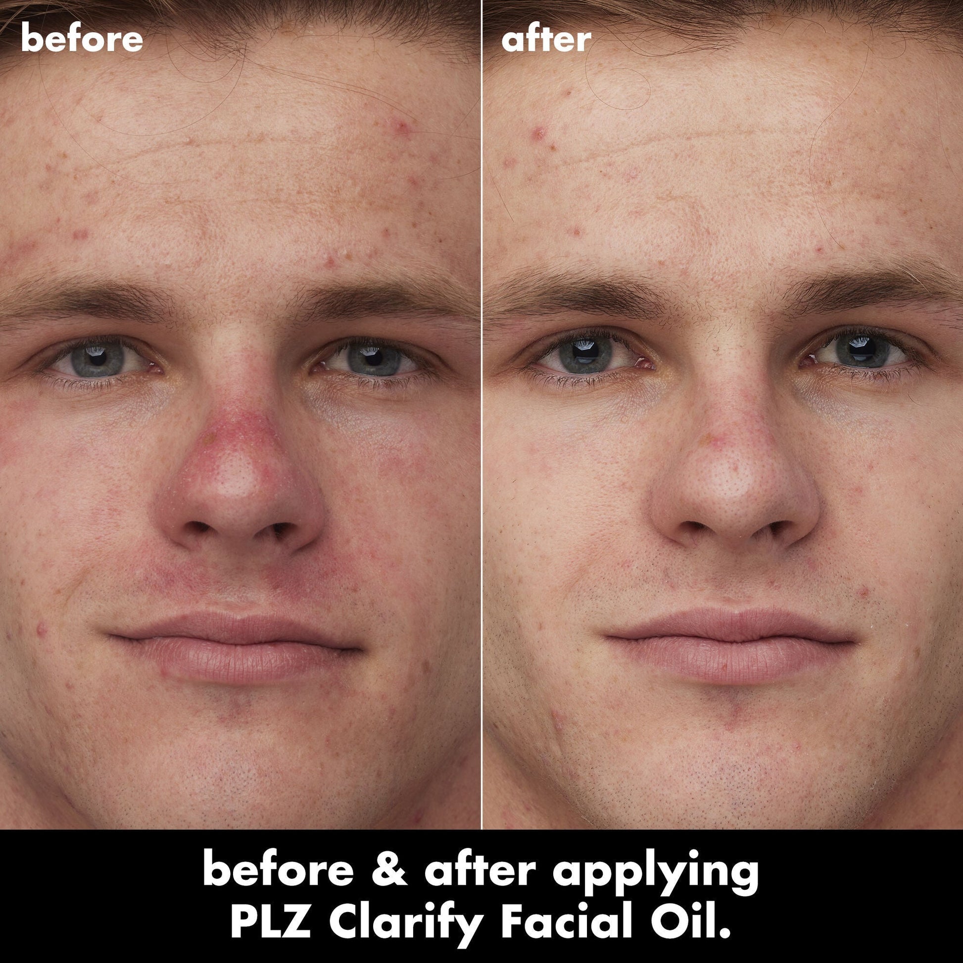 plz-clarify-facial-oil-q2 0326_EDU_PlzClarify_BA_Caleb.jpg