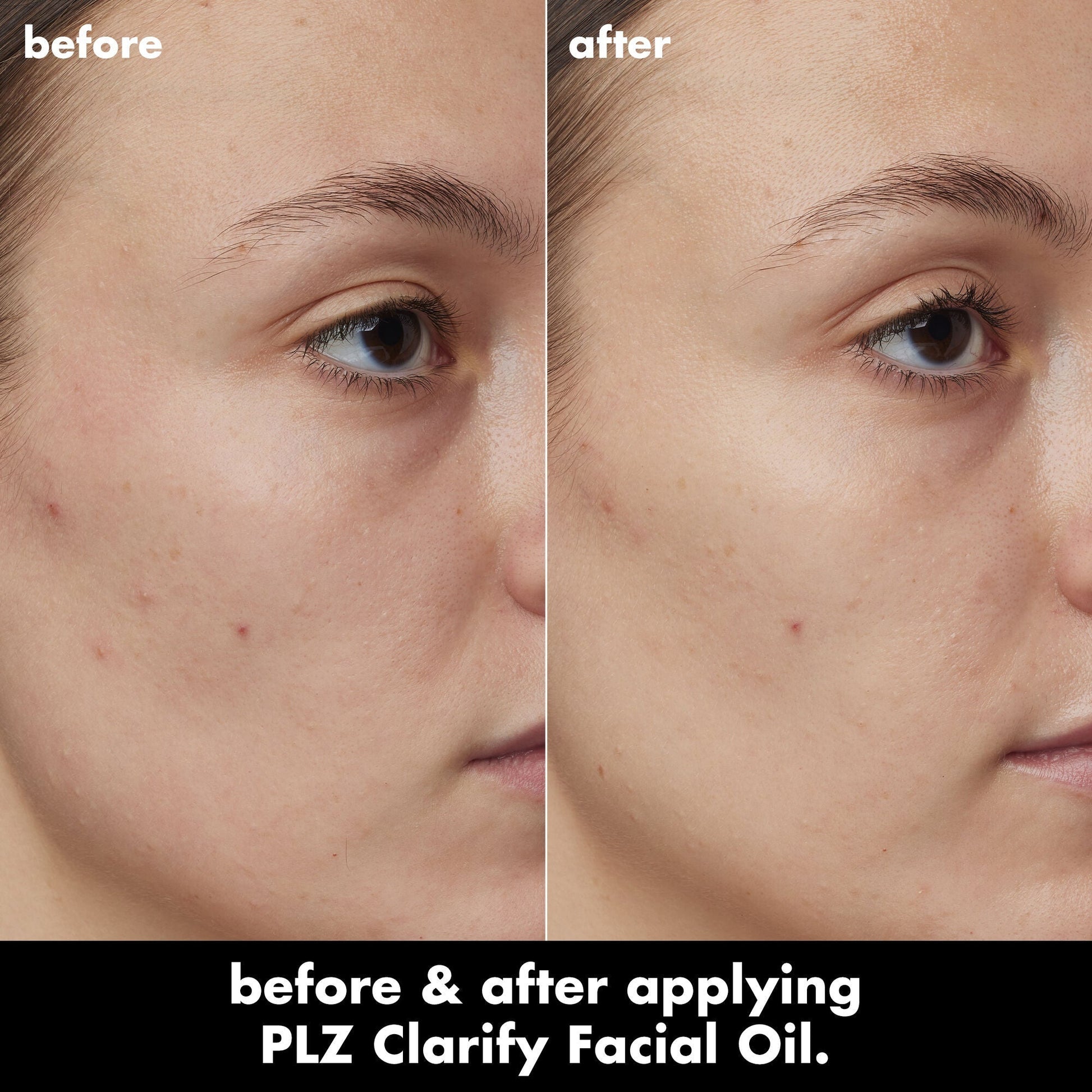 plz-clarify-facial-oil-q2 0326_EDU_PlzClarify_BA_Kelly.jpg