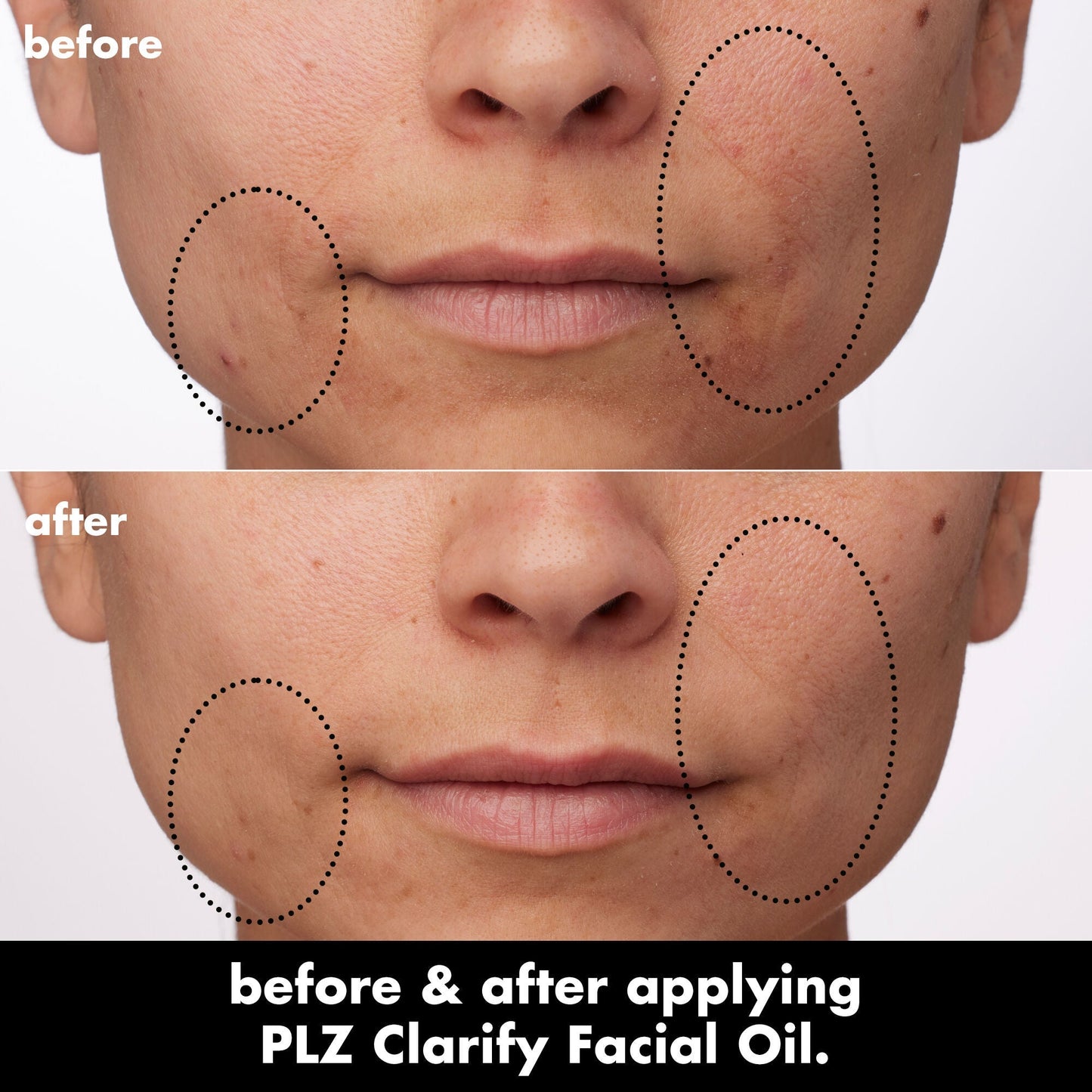 plz-clarify-facial-oil-q2 0326_EDU_PlzClarify_BA_Paula.jpg
