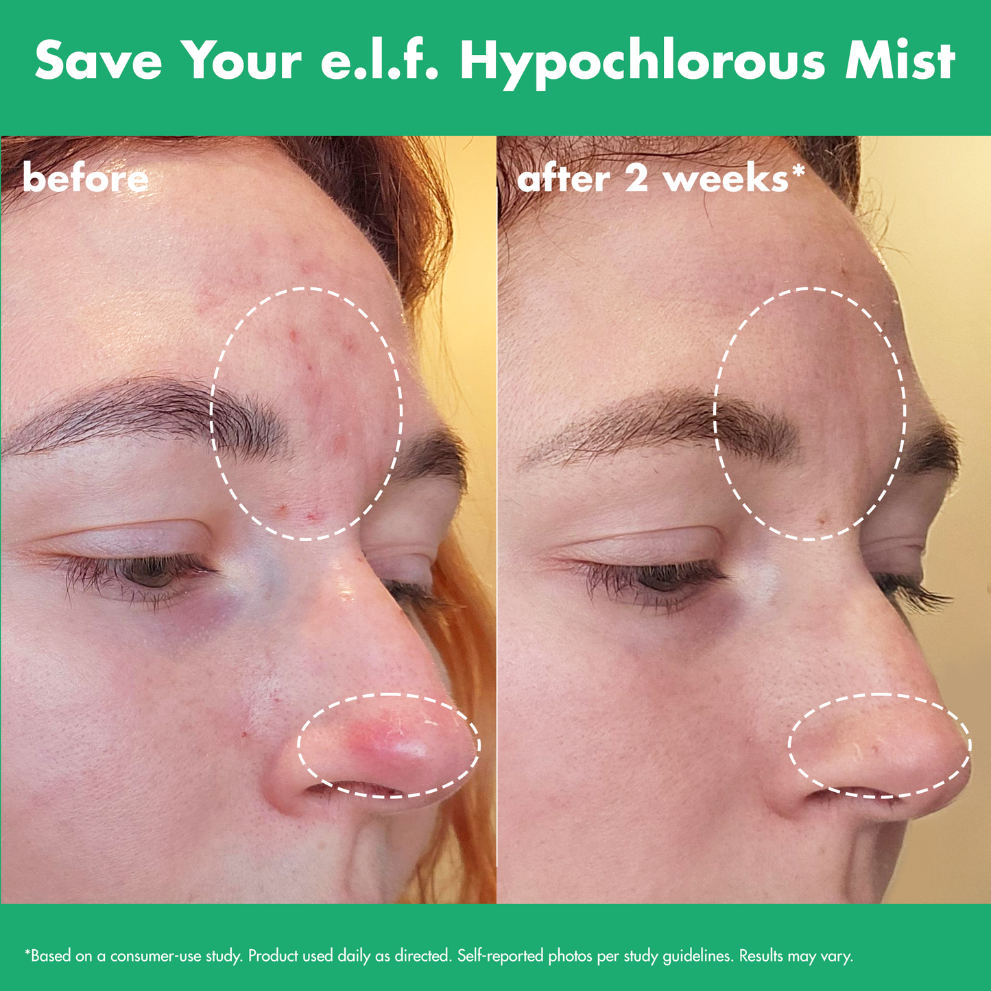 save-your-e-l-f-hypochlorous-mist-r7 FA26_EDUCATION_SAVEYOURELF_USAGE_BA1_WITHOUT_CLAIMS.png