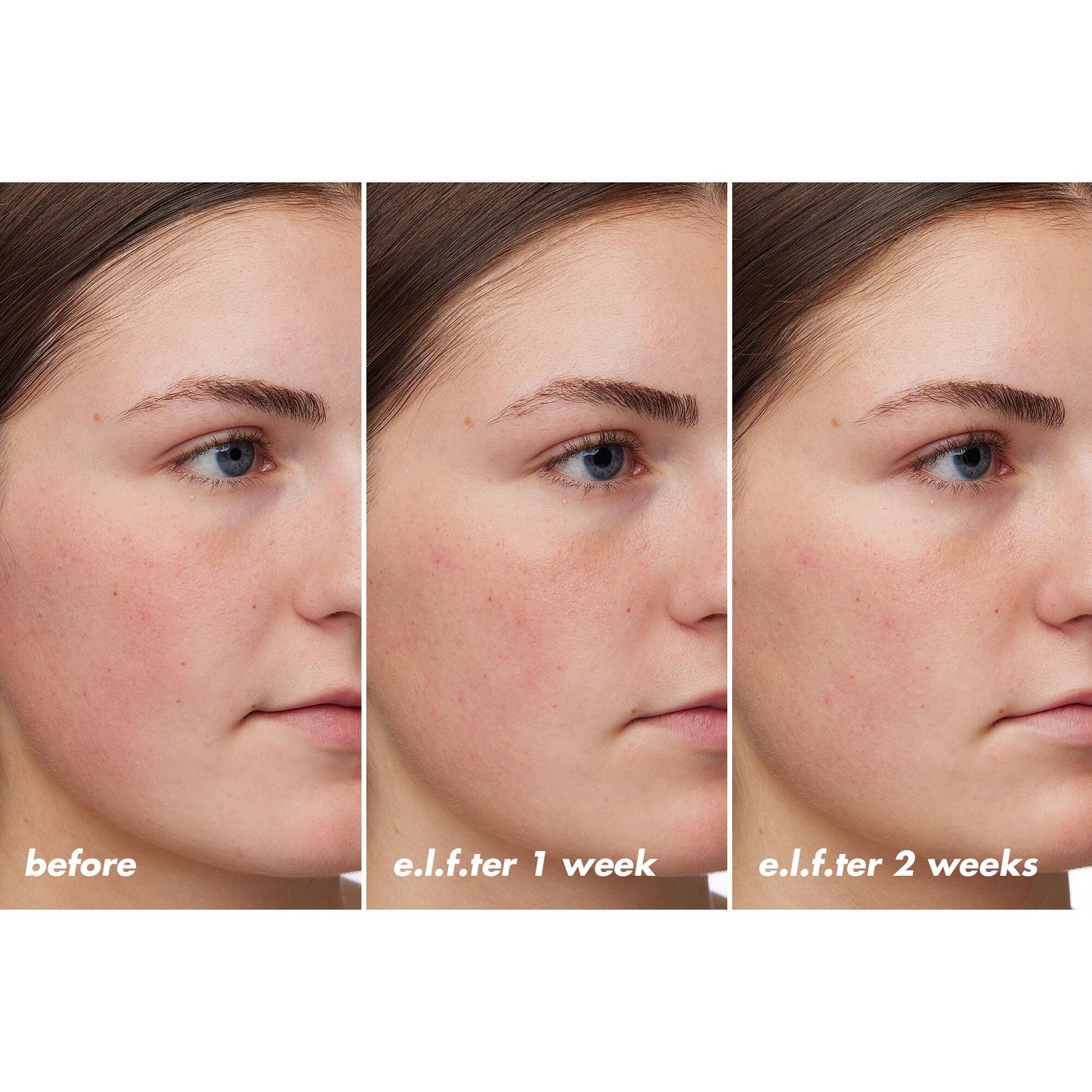 holy-hydration-barrier-goals-cream-regular-v1 XX26_EDUCATION_HH-BarrierGoals_B_A_Zoe_TRYPTICH_74c905bd-67bd-4b91-b633-2b01a8905cb8.jpg